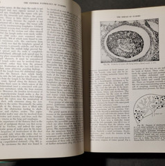 BOYD&rsquo;S PATHOLOGY FOR THE SURGEON 8th Ed.by William Anderson 1967 HC Saunders