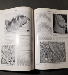 BOYD&rsquo;S PATHOLOGY FOR THE SURGEON 8th Ed.by William Anderson 1967 HC Saunders