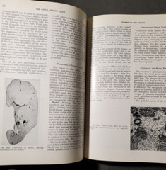 BOYD&rsquo;S PATHOLOGY FOR THE SURGEON 8th Ed.by William Anderson 1967 HC Saunders